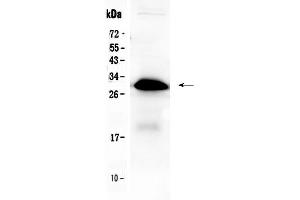 Western blot analysis of IGFBP1 using anti-IGFBP1 antibody . (IGFBPI antibody  (AA 69-259))