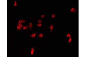 Immunofluorescence (fixed cells) (IF/ICC) image for anti-Iroquois Homeobox Protein 2 (IRX2) (Internal Region) antibody (ABIN6262670)