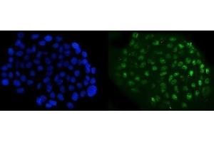 IF analysis of NFIB/NF1B2 using anti-NFIB/NF1B2 antibody (ABIN7602995). (NFIB antibody  (Middle Region))