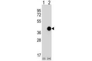 Western blot analysis of CTSK (arrow) using CTSK Antibody (Center) Cat. (Cathepsin K antibody  (Middle Region))