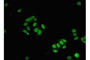 Immunofluorescent analysis of HepG2 cells using ABIN7169690 at dilution of 1:100 and Alexa Fluor 488-congugated AffiniPure Goat Anti-Rabbit IgG(H+L) (STAT6 antibody  (AA 1-319))