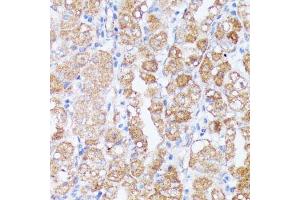 Immunohistochemistry of paraffin-embedded human stomach using SPON2 antibody (ABIN6129679, ABIN6148370, ABIN6148372 and ABIN6215647) at dilution of 1:100 (40x lens). (SPON2 antibody  (AA 27-150))