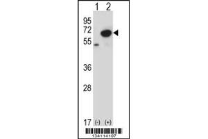 Western blot analysis of PNKP using rabbit polyclonal PNKP Antibody using 293 cell lysates (2 ug/lane) either nontransfected (Lane 1) or transiently transfected (Lane 2) with the PNKP gene. (PNKP antibody  (N-Term))