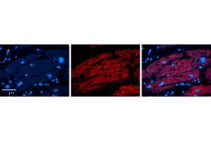 Rabbit Anti-IRF1 Antibody Catalog Number: ARP31296_P050 Formalin Fixed Paraffin Embedded Tissue: Human heart Tissue Observed Staining: Cytoplasmic Primary Antibody Concentration: 1:100 Other Working Concentrations: 1:600 Secondary Antibody: Donkey anti-Rabbit-Cy3 Secondary Antibody Concentration: 1:200 Magnification: 20X Exposure Time: 0.