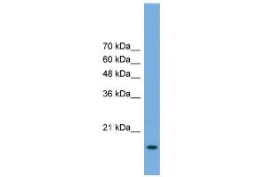 WB Suggested Anti-POP5 Antibody Titration: 0. (POP5 antibody  (Middle Region))