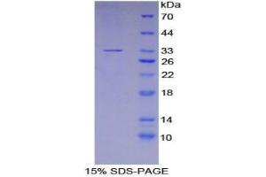 SDS-PAGE analysis of Human P2RY14 Protein. (P2RY14 Protein)