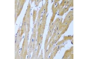 Immunohistochemistry of paraffin-embedded rat heart using IGF2BP3 antibody. (IGF2BP3 antibody  (AA 1-200))