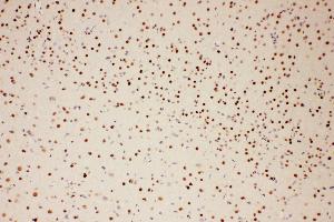 Anti-PIAS1 antibody, IHC(P) IHC(P): Rat Brain Tissue (PIAS1 antibody  (C-Term))