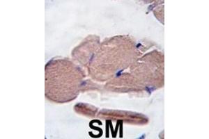 Immunohistochemistry (IHC) image for anti-Myostatin (MSTN) antibody (ABIN2916193) (MSTN antibody)
