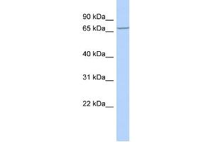 WB Suggested Anti-LRCH4 Antibody Titration:  0. (LRCH4 antibody  (Middle Region))