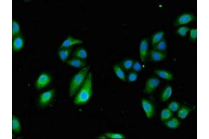 Immunofluorescent analysis of HepG2 cells using ABIN7171676 at dilution of 1:100 and Alexa Fluor 488-congugated AffiniPure Goat Anti-Rabbit IgG(H+L) (TCTN3 antibody  (AA 348-472))