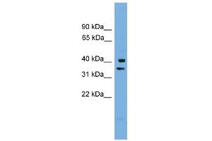 WB Suggested Anti-PNRC1 Antibody Titration: 0. (PNRC1 antibody  (Middle Region))