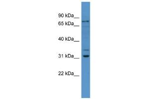 WB Suggested Anti-Fbxo34 Antibody Titration: 0. (FBXO34 antibody  (N-Term))