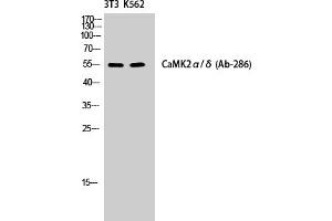 Western Blotting (WB) image for anti-CaMKIIalpha/delta (Thr286) antibody (ABIN5960662) (CaMKIIalpha/delta antibody  (Thr286))