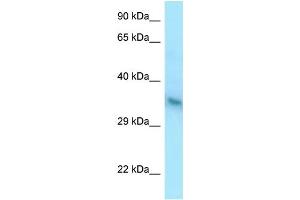 WB Suggested Anti-YIPF1 Antibody Titration: 1. (YIPF1 antibody  (C-Term))