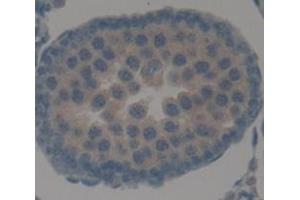 Figure. (APPBP2 antibody  (AA 396-585))