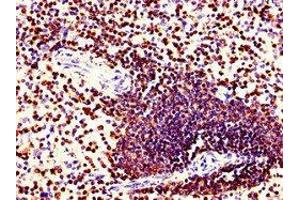 Immunohistochemistry of paraffin-embedded human spleen tissue using ABIN7148593 at dilution of 1:100 (Coronin 1a antibody  (AA 363-432))