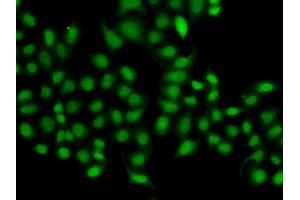 Immunofluorescence analysis of A549 cell using SULT2B1 antibody. (SULT2B1 antibody)