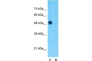Host:  Rabbit  Target Name:  TEAD4  Sample Type:  293T  Lane A:  Primary Antibody  Lane B:  Primary Antibody + Blocking Peptide  Primary Antibody Concentration:  1ug/ml  Peptide Concentration:  5ug/ml  Lysate Quantity:  25ug/lane/lane  Gel Concentration:  0. (TEAD4 antibody  (C-Term))