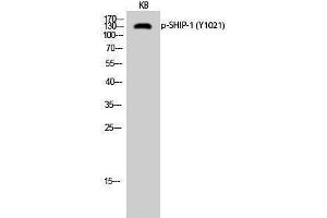 Western Blotting (WB) image for anti-Inositol Polyphosphate-5-Phosphatase, 145kDa (INPP5D) (pTyr1021) antibody (ABIN3182231) (INPP5D antibody  (pTyr1021))