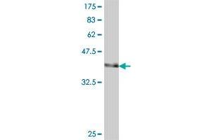 Western Blot detection against Immunogen (37. (PREB antibody  (AA 51-150))