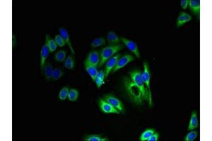 Immunofluorescent analysis of HepG2 cells using ABIN7163920 at dilution of 1:100 and Alexa Fluor 488-congugated AffiniPure Goat Anti-Rabbit IgG(H+L) (KCNK13 antibody  (AA 292-408))