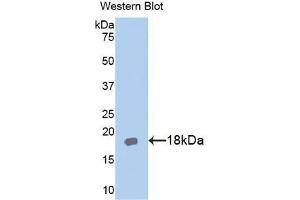 Western blot analysis of the recombinant protein. (IL18RAP antibody  (AA 396-548))