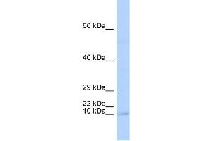 TAL2 antibody used at 1. (TAL2 antibody  (N-Term))