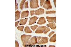 Immunohistochemistry (IHC) image for anti-Enoyl-CoA Delta Isomerase 2 (PECI) antibody (ABIN3003871) (PECI/ECI2 antibody)