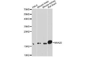 Western blot analysis of extracts of various cell lines, using NAA20 antibody (ABIN5974272) at 1/1000 dilution. (NAT5 antibody)