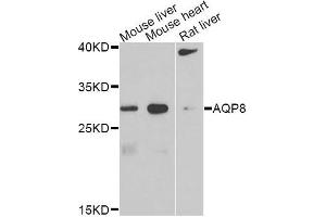 Western blot analysis of extracts of various cell lines, using AQP8 antibody. (Aquaporin 8 antibody)