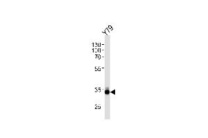OTX2 Antibody (C-term) (ABIN1881611 and ABIN2845106) western blot analysis in Y79 cell line lysates (35 μg/lane).