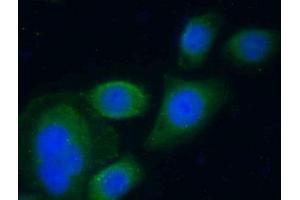 Detection of SERPINA10 in Human HepG2 Cells using Polyclonal Antibody to Serpin A10 (SERPINA10) (SERPINA10 antibody  (AA 278-425))