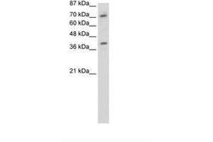 ZNF282 anticorps  (C-Term)