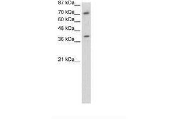 ZNF282 antibody  (C-Term)