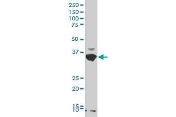 AKR1C2 antibody  (AA 224-323)