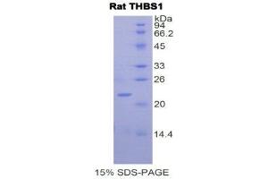 SDS-PAGE (SDS) image for Thrombospondin 1 (THBS1) (AA 957-1129) protein (His tag) (ABIN2122201) (Thrombospondin 1 Protein (THBS1) (AA 957-1129) (His tag))