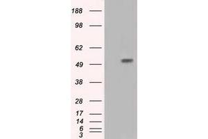 Western Blotting (WB) image for anti-Intraflagellar Transport 57 Homolog (IFT57) antibody (ABIN1498811) (IFT57 antibody)