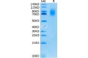 Human CD30 on Tris-Bis PAGE under reduced condition. (TNFRSF8 Protein (AA 19-379) (His-Avi Tag))
