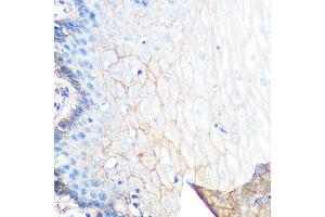 Immunohistochemistry of paraffin-embedded human esophageal using S100 Rabbit mAb (ABIN7270122) at dilution of 1:100 (40x lens). (S100A10 antibody)