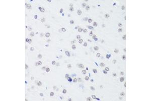 Immunohistochemistry of paraffin-embedded rat brain using TriMethyl-Histone H3-K64 antibody (ABIN7267701) at dilution of 1:100 (40x lens). (Histone 3 antibody  (H3K64me3))