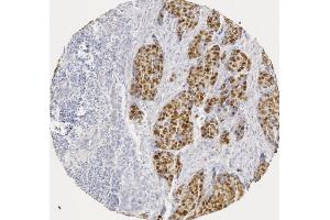 Immunohistochemistry (IHC) image for anti-Tumor Protein P53 (TP53) (AA 20-31) antibody (ABIN4219254)