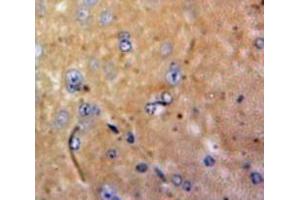Used in DAB staining on fromalin fixed paraffin-embedded Brain tissue (M-CSF/CSF1 antibody  (AA 33-204))