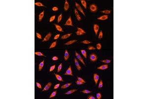 Immunofluorescence analysis of L929 cells using GALNS Rabbit pAb (ABIN6131691, ABIN6140937, ABIN6140938 and ABIN6221120) at dilution of 1:100 (40x lens). (GALNS antibody  (AA 353-522))