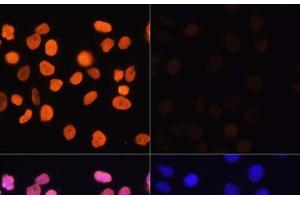 Immunofluorescence analysis of HeLa cells using Acetyl-Histone H3-K4 Polyclonal Antibody at dilution of 1:100. (Histone 3 antibody  (acLys4))