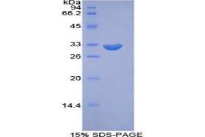 SDS-PAGE analysis of Mouse PIKFYVE Protein. (PIKFYVE Protein)