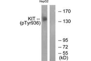 Western blot analysis of extracts from HepG2 cells treated with EGF 200ng/ml 30', using KIT (Phospho-Tyr936) Antibody. (KIT antibody  (pTyr936))