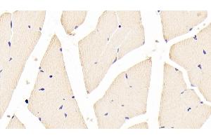 Detection of FOXO1 in Mouse Skeletal muscle Tissue using Polyclonal Antibody to Forkhead Box Protein O1 (FOXO1) (FOXO1 antibody  (AA 222-469))