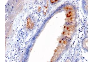 Immunohistochemistry (IHC) image for anti-Mucin 4, Cell Surface Associated (MUC4) (AA 1730-1864) antibody (ABIN6940125)
