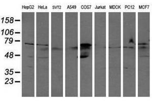 Image no. 2 for anti-Aldehyde Dehydrogenase 3 Family, Member A2 (ALDH3A2) antibody (ABIN1496594) (ALDH3A2 antibody)